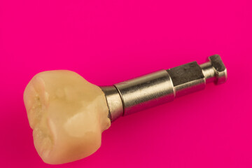 ceramic dental crown for fixation on a dental implant