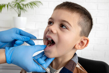 A boy is being examined by a dentist. There are cavities on his teeth.