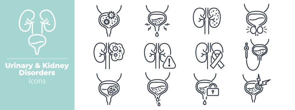 Medical urinary system icons showing kidney stones, bladder infections, and prostate gland illustrations in minimal outline design for health resources and clinical use. Vector. Editable stroke