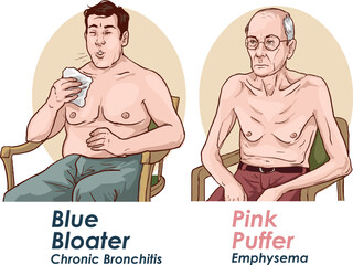 blue bloater vs pink puffers stock  vector illustrationchronic 