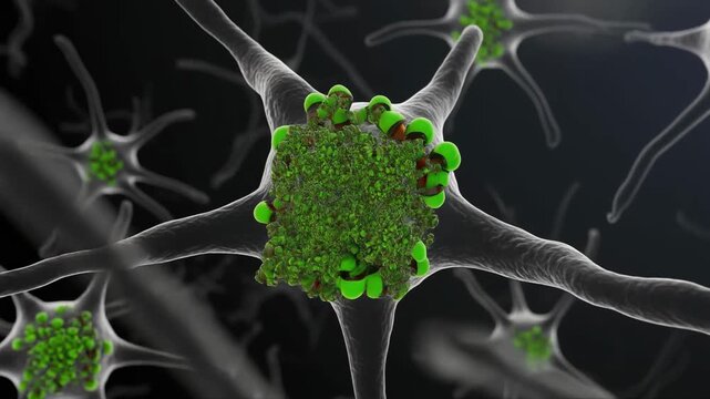 Microscopic view of SOD1 ALS pathology in a 3D motor neuron.