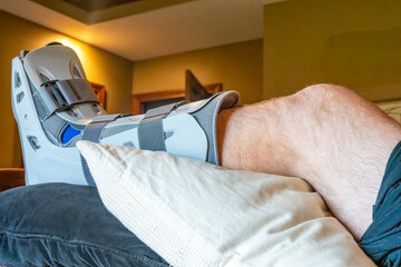 Foot in a medical boot resting on a pillow in a living room during the daytime