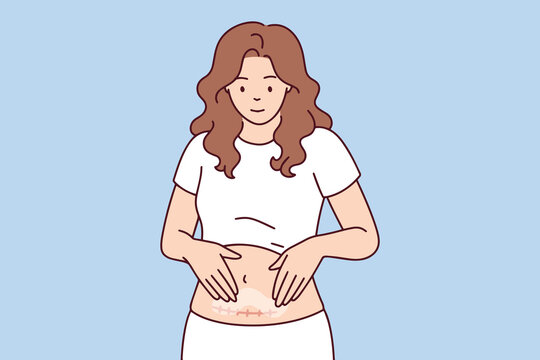 Young mother performs belly massage after cesarean section surgery using medical ointment for skin recovery. Concept of postpartum health, surgical wound care, and female body acceptance.