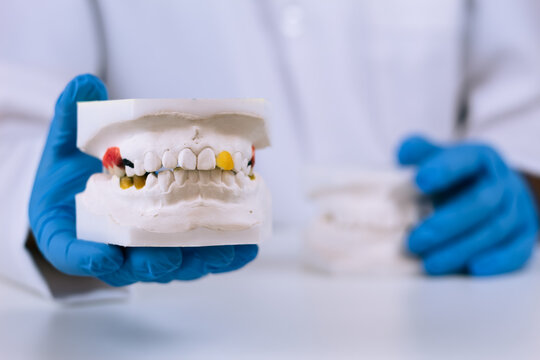Bone support assessment on a dental plaster model. The dentist diagnoses periodontal disease and plans gum treatment in a modern professional clinic.