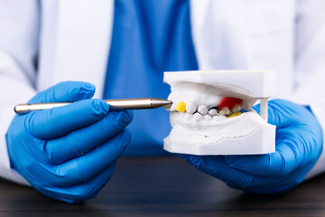 Dentist explaining comprehensive treatment plan using an articulated plaster model of the human jaw, patient education, dental consultation, visual diagnosis, oral health, clinical prevention
