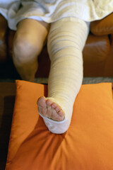bandaged leg resting on an orange cushion