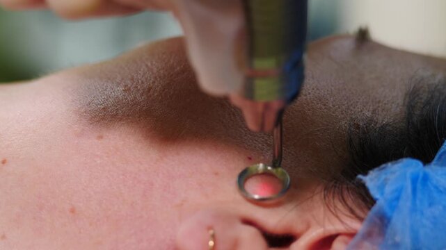 Laser cosmetic surgery and skin resurfacing rejuvenation in dermatology clinic. Beauty laser technician performing skin care anti wrinkle procedure in modern spa and beauty clinic. Laser procedure