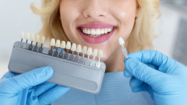 Dentist in blue medical gloves applying sample from tooth enamel scale to unrecognizable happy woman patient teeth to pick up right shade, teeth bleaching procedure, cropped, panorama