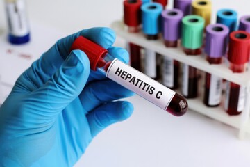 Obraz premium Hand in blue glove holding sample tube labeled Hepatitis C medical test laboratory