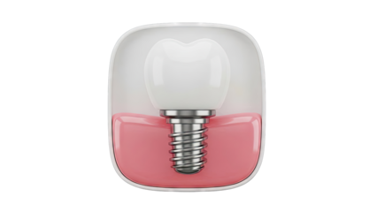 Dental Implant with Tooth Crown and Gum Cross-Section