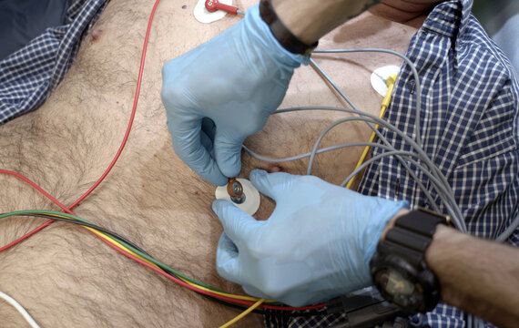 Electrocardiogram of heart. A nurse's hands place electrodes on a patient's chest