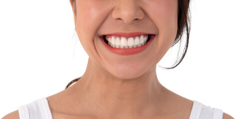Radiant Smile: An image of a woman's beaming smile reveals bright, healthy teeth, evoking a sense of joy and confidence.