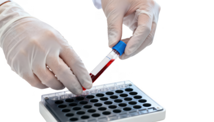 Gloved hands carefully placing a blood sample tube near an analyzer tray on a clean lab bench showcasing precise electrolyte panel testing in a clinical setting.