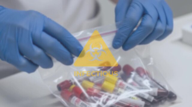 Medical professional in blue protective gloves carefully sealing a clear biohazard bag filled with multiple blood samples for crucial laboratory testing and analysis