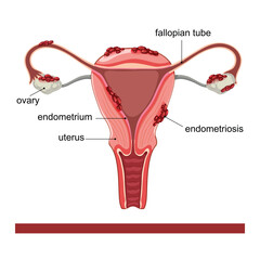 simple vector clipart,