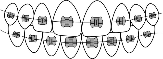 teeth with dental brackets ortho