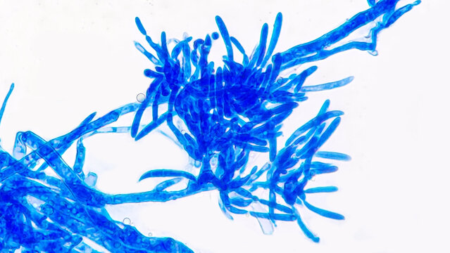 Fusarium citri sporodochial conidiophores bearing macroconidia under microscope. Lactophenol blue staining