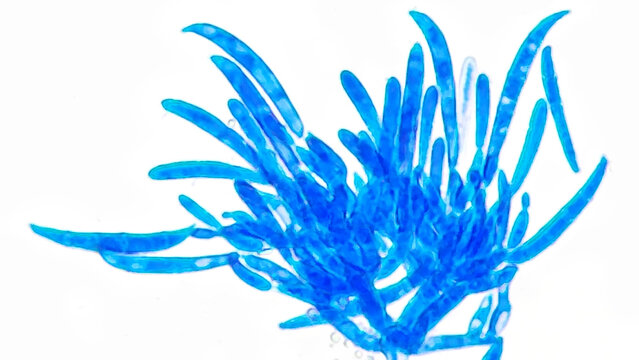 Fusarium citri sporodochial conidiophores bearing macroconidia under microscope. Lactophenol blue staining