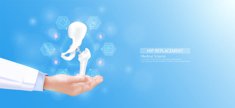 Hip replacement model in doctor hand. Bone joint surrounded by medical icons. Technologies in science health care. Realistic 3D Vector.
