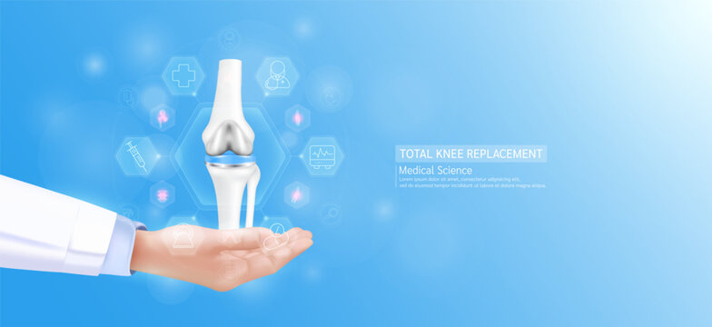 Total knee replacement model in doctor hand. leg joint bone surrounded by medical icons. Technologies in science health care. Realistic 3D Vector.
