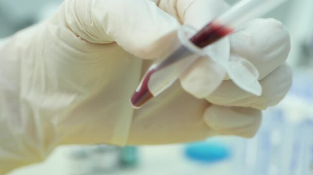 Laboratory. Spectrometer apparatus for material research. Laboratory apparatus for research. Human science. Material for laboratory research. Medicine