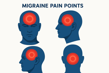 of migraine pain points on human head in profile and front views