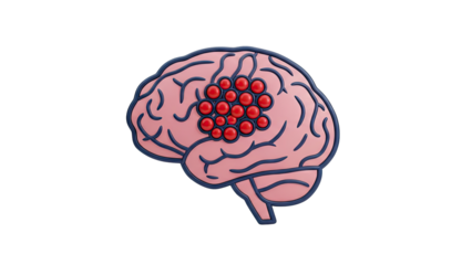 Brain Tumor Illustration