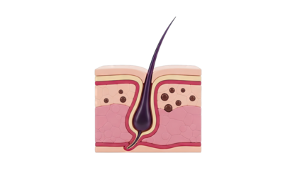 Cross-section of skin with hair follicle and melanin granules
