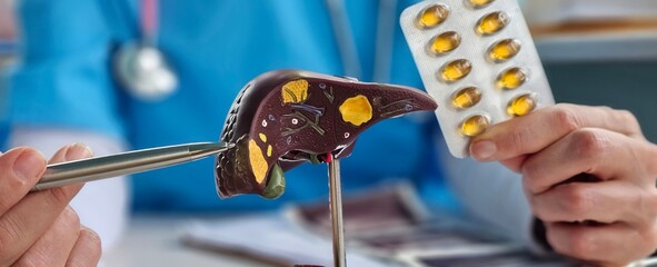 Yellow capsules with fish oil scattered doctor holds liver model concept