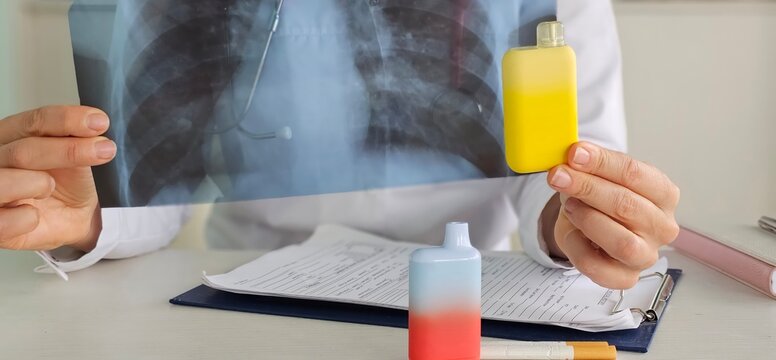 A doctor holds a vape and an x-ray of the lungs. The consequences of smoking vape electronic cigarettes - Powered by Adobe
