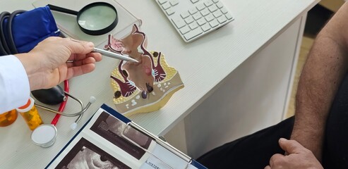 Doctor and patient with rectum and hemorrhoids human anatomical model in hospital, inflamed vascular structure concept
