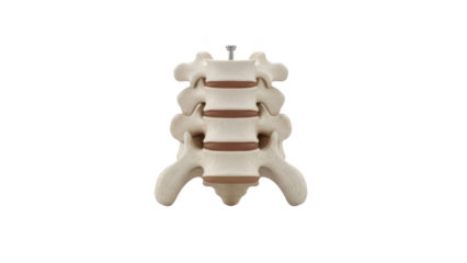 Anatomical Model of Lumbar Vertebrae with Intervertebral Discs and Screw spine anatomy