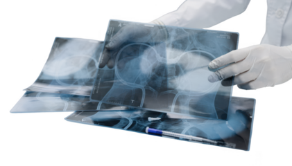 Printed ureteral stent placement films held up for detailed review in a clinical setting emphasizing patient followup care on a clean white surface.