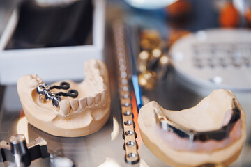 Crafting precision dental prosthesis on workbench of Cnc machine