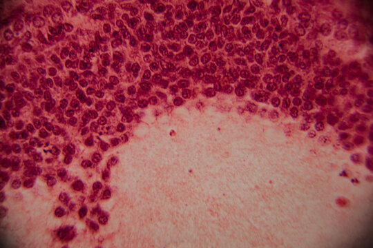 Microscopic view of a developing ovarian follicle with distinct granulosa cells and oocyte at the center, stained for histological analysis.