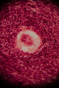 Microscopic view of a developing ovarian follicle with distinct granulosa cells and oocyte at the center, stained for histological analysis.
