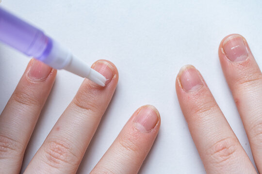 Little teenage girl applying cuticle emulsion on her nails. Nail care, manicure. Close-up. Diverse Beauty