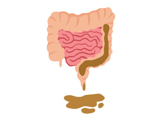 Hand Drawn Diarrhea Disease in Intestines
