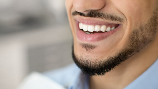 Dentistry Concept. Closeup Of Happy Young Middle Eastern Man Widely Smiling With Perfect Teeth While Sitting In Chair In Dental Clinic, Arab Guy Enjoying Result Of Stomatologic Treatment, Cropped