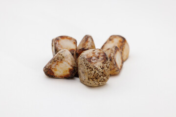 手術で摘出された多数の胆石、白背景