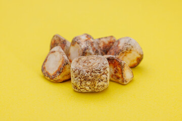 手術で摘出された多数の胆石、黄背景