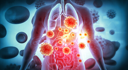 A realistic 3D anatomical illustration depicting the human digestive tractâ€”including the esophagus, stomach, small intestine, and large intestine suffering from an acute viral infection