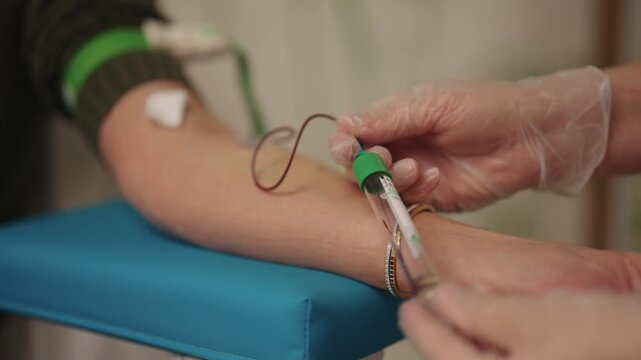 Close-up of phlebotomist drawing blood sample from female patient arm wearing tourniquet, preparing for laboratory analysis and health diagnostics with sterile equipment. Shooting in slow motion.