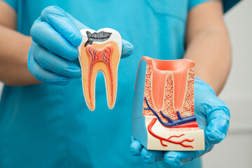 Asian dentist holding dental implant, artificial tooth roots into jaw, root canal of dental treatment, gum disease, teeth model for dentist.