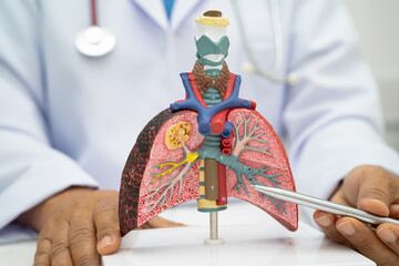 Pneumonia, lung cancer, Asian doctor holding human anatomy model for study diagnosis and treatment in hospital.