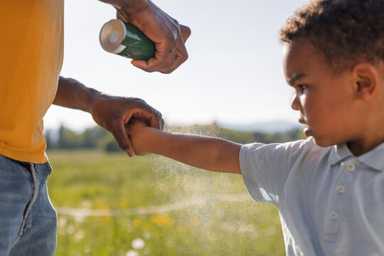 Dad carefully applies insect and tick protection to his little son, spraying repellent on his skin and clothing while spending time in nature