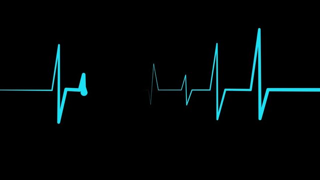Heartbeat Line Wave Signal Animation with Continuous Pulse and Medical Monitoring