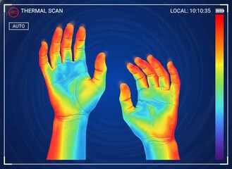 Thermal Hand Scan