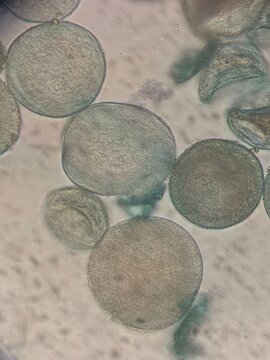 Microscopic Morphological Analysis of Tulipa Gesneriana Pollen Grains and Structure