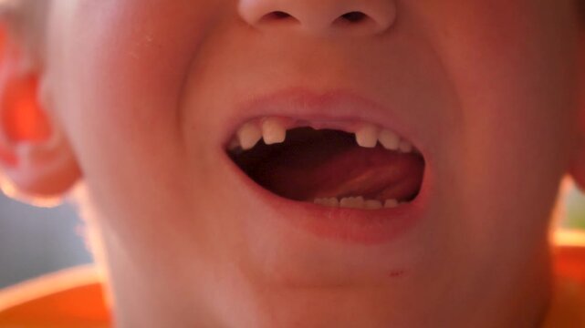 Extreme close up of child mouth showing gap where a milk tooth has fallen out. The toothless boy wiggles his tongue in the empty space, common milestone in childhood development.